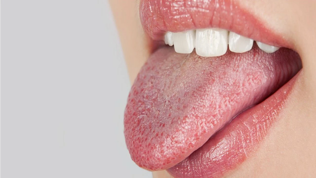 The Science Behind Dry Mouth: What Causes It and How to Prevent It