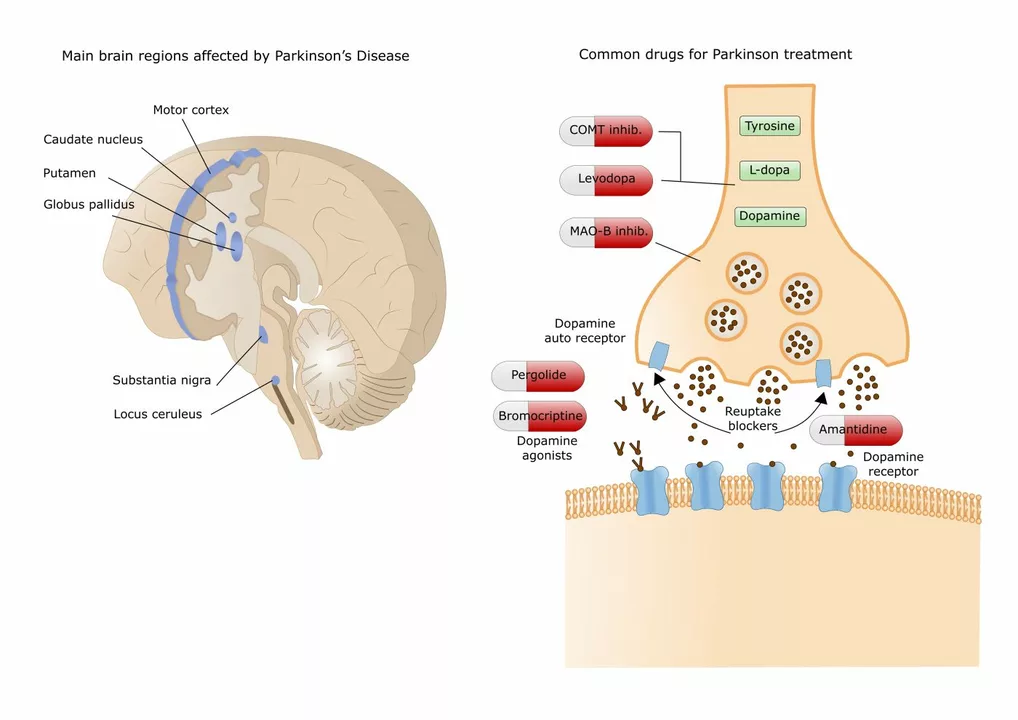Trihexyphenidyl and Music Therapy: Can It Improve Motor Function in Parkinson's Disease?